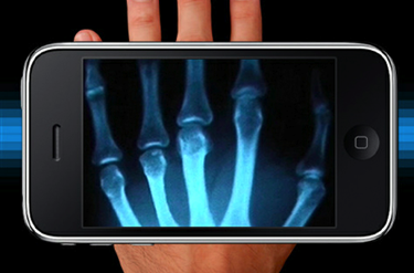 蓝菲光学的成套医疗成像测试设备改善了基于闪烁晶体的荧光成像